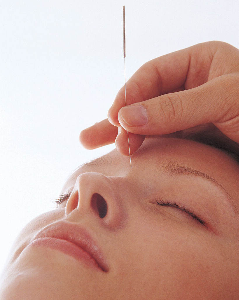 Acupuntura Clínica Alternative Care