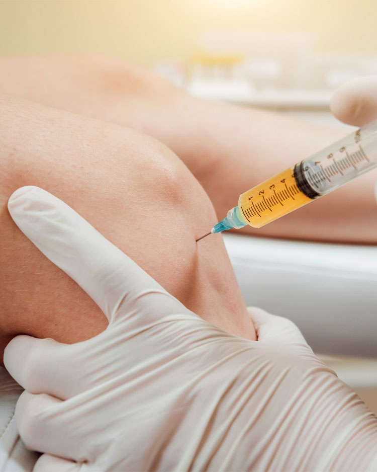 PRP - Plasma Rico en Plaquetas Clínica Alternative Care